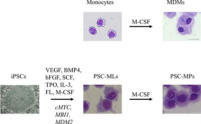 Induced Pluripotent Stem Cell-Derived Monocytes/Macrophages in Autoinflammatory Diseases